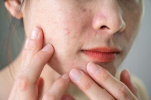 7 bí quyết làm mịn da mặt hiệu quả giúp làn da luôn khỏe mạnh và tươi trẻ